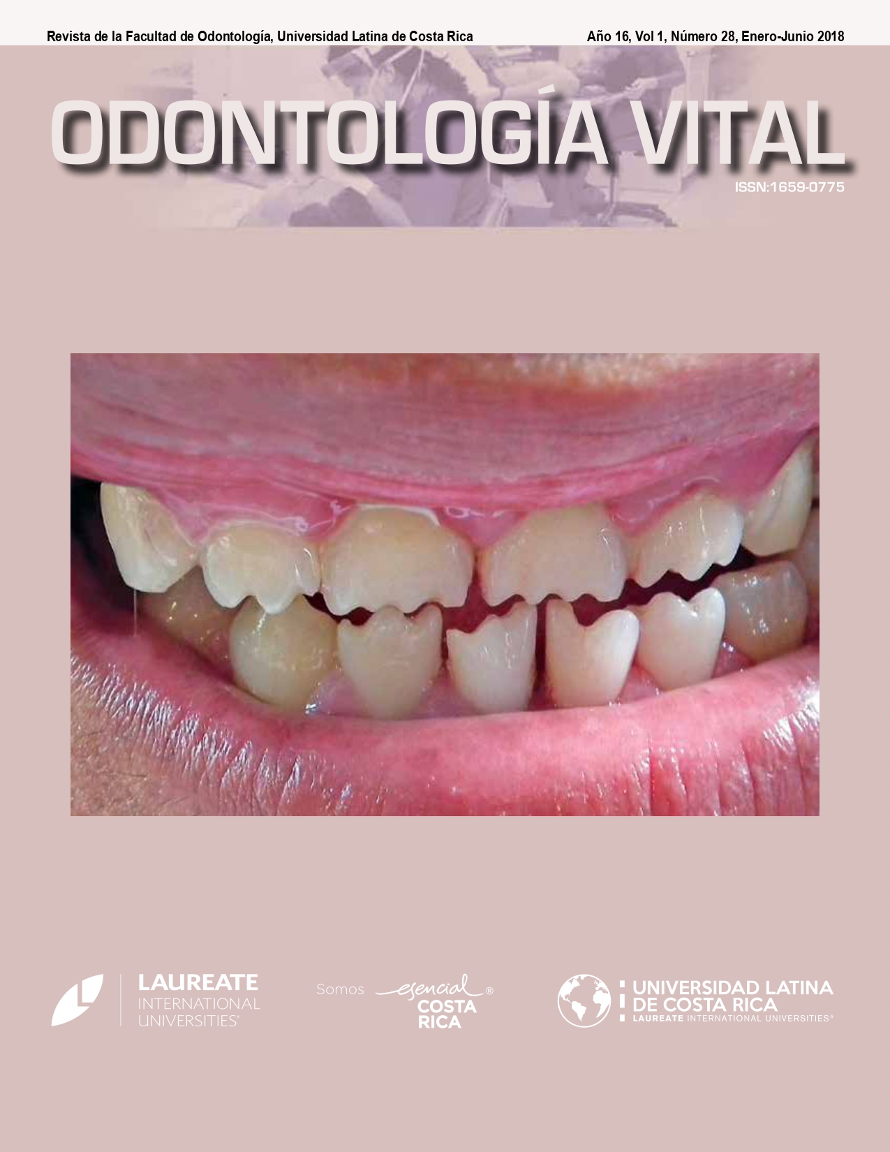 					Ver Vol. 1 Núm. 28 (16): Odontología Vital, Núm 28, Enero - Junio 2018.
				