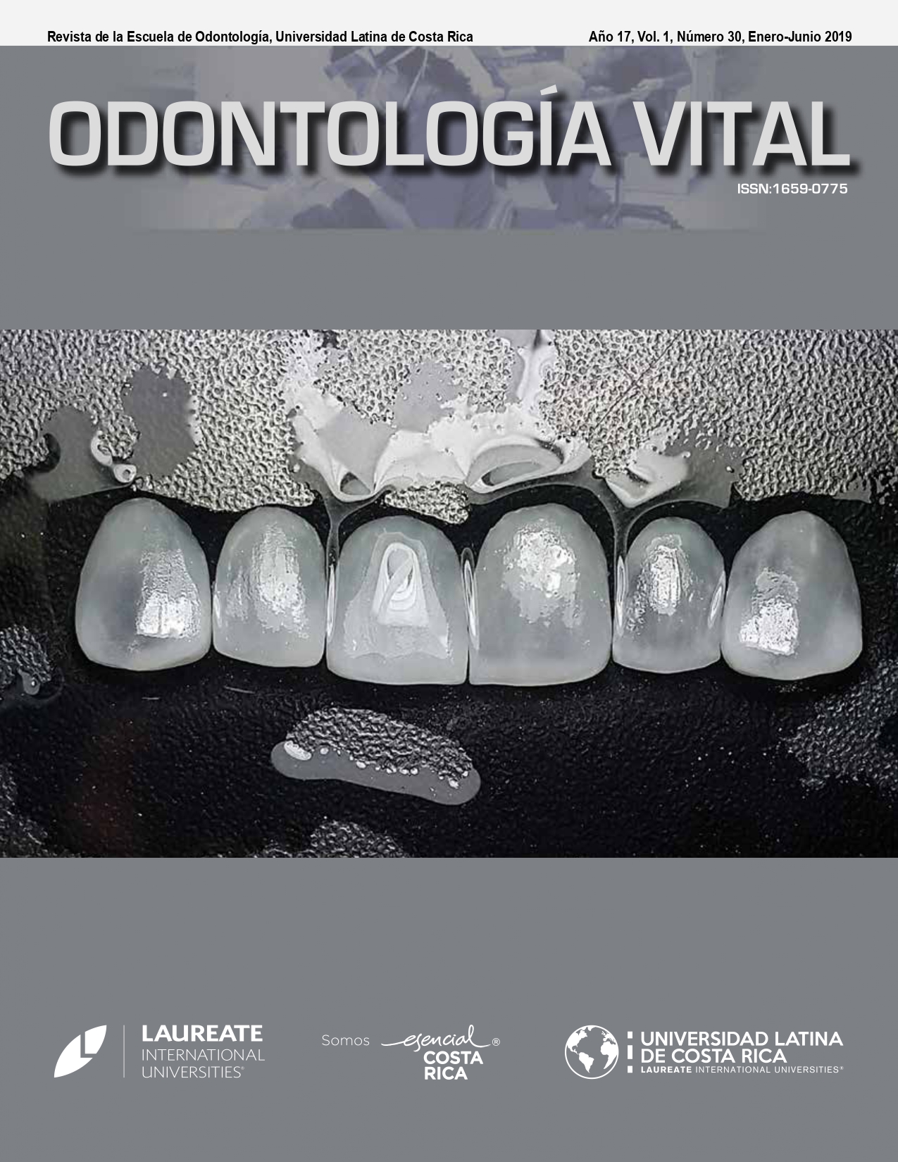 					Ver Vol. 1 Núm. 30 (17): Odontología Vital, Núm 30, Enero - Junio 2019.
				